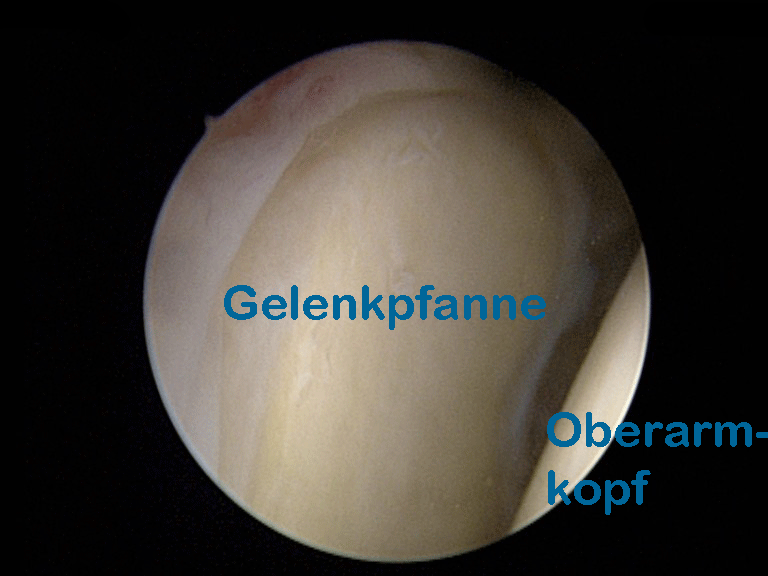 Glenohumeralgelenk